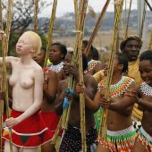 голая девушка папуаска альбинос